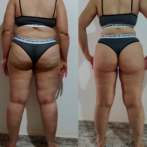 Lisa M. experience